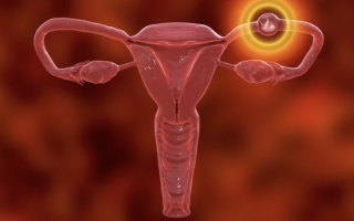 IVF and Ectopic Pregnancy: Everything You Need to Know